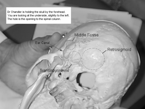 Skull.jpg (37688 bytes)