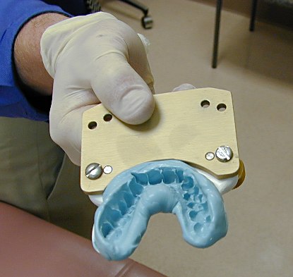 dental_impression.jpg (30590 bytes)